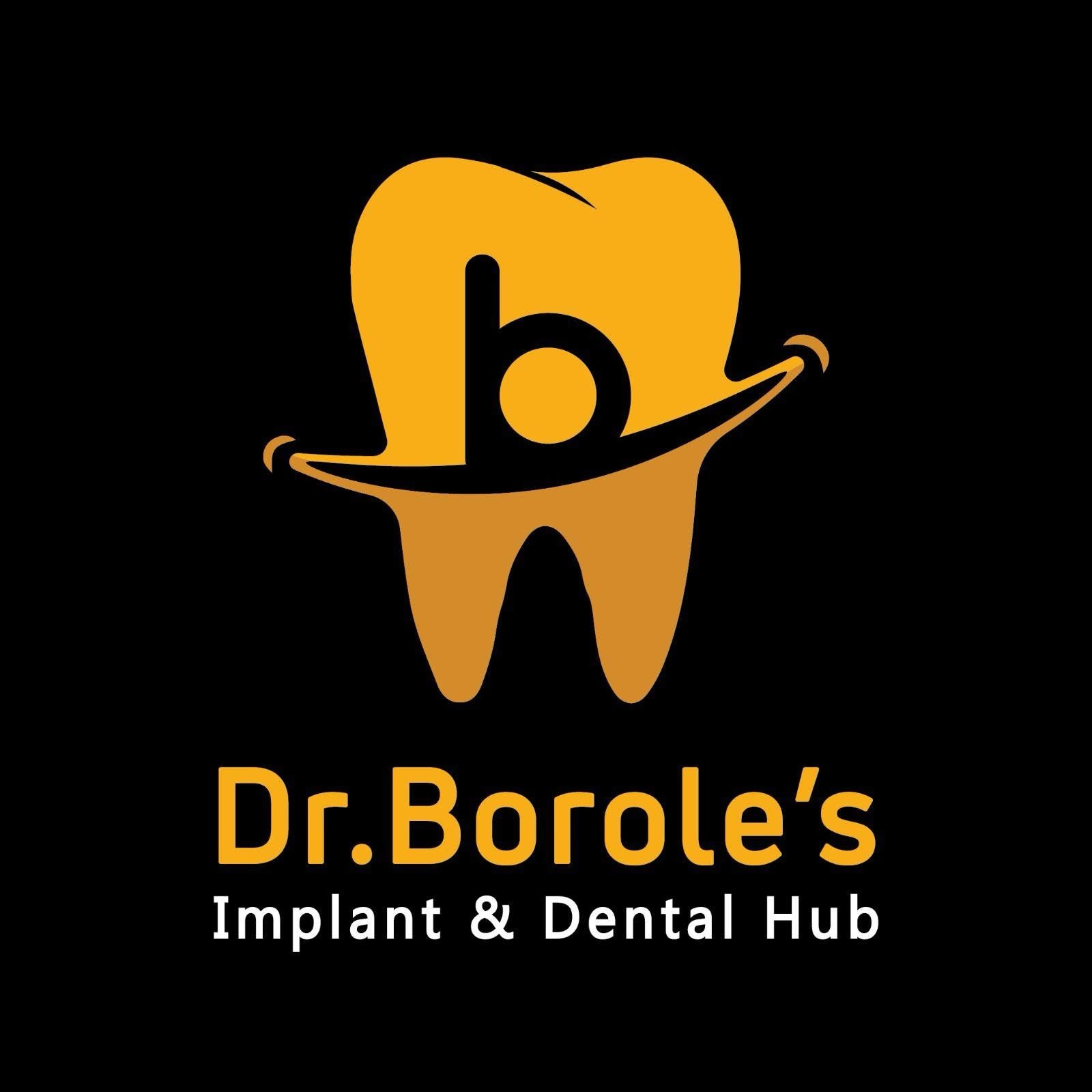 Anand Dental clinic & implant center Nanded City Pune